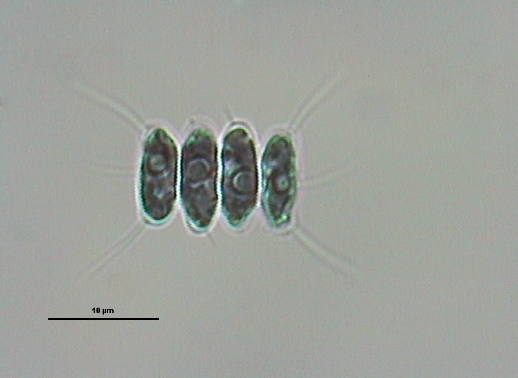 Dictyocha speculum